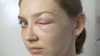 Göz dokunmadan Anti kadınla