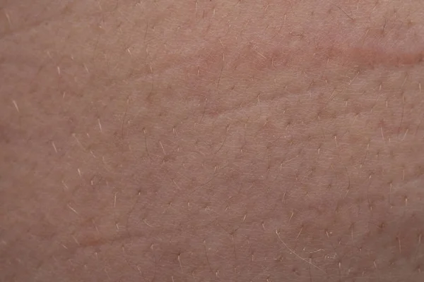 Imagem da pele humana com pequenos cabelos, foto close-up — Fotografia de Stock