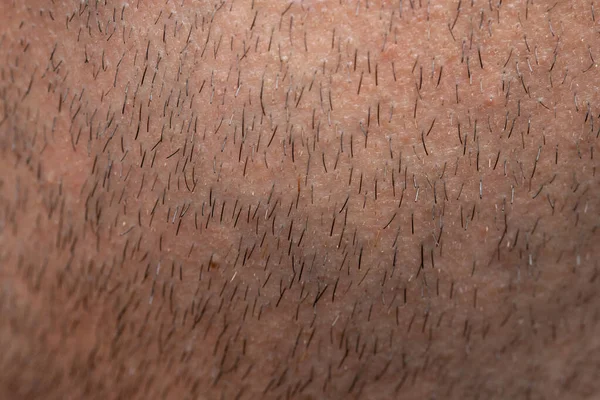 Textura de la cerda del hombre con pelos negros, foto de primer plano — Foto de Stock
