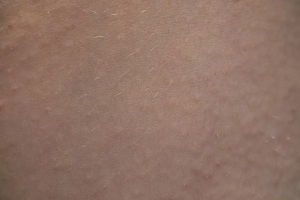 Macro foto de la textura de la piel del joven rosa humano — Foto de Stock