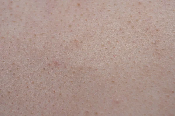 Macro shooting of the young pink human's epidermis texture — Stock Photo, Image