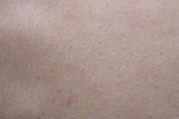 Makrofotografering av den unge människans epidermis textur — Stockfoto