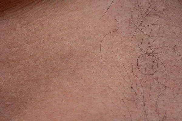 Textur der Haut mit schwarzen Haaren, Nahaufnahme Foto — Stockfoto