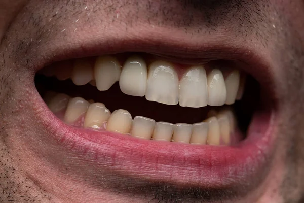 Bild av ung man med öppen mun, visar tänder — Stockfoto