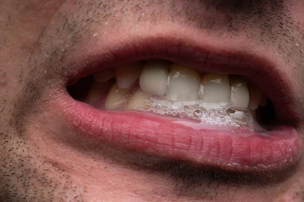 Imagem do jovem com saliva, mostrando os dentes — Fotografia de Stock