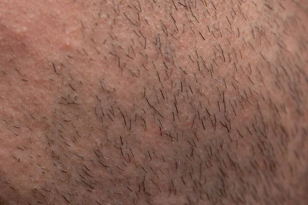 Tekstur manusia rapuh dengan rambut hitam kecil, foto closeup — Stok Foto
