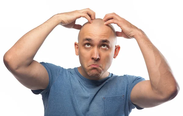 Image of bald man touching shaved head — Stock Photo, Image