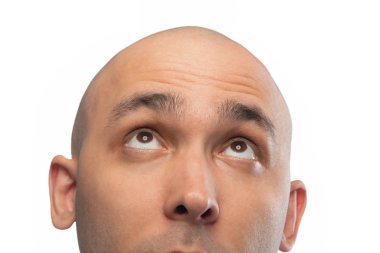 Photo of bald man looking up, half head