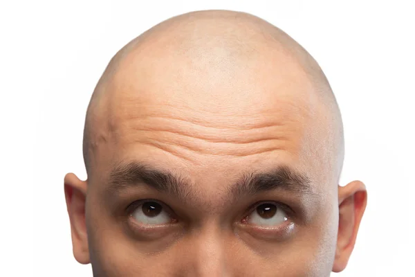 Photo of shaved man looking up, half head — Stock Photo, Image