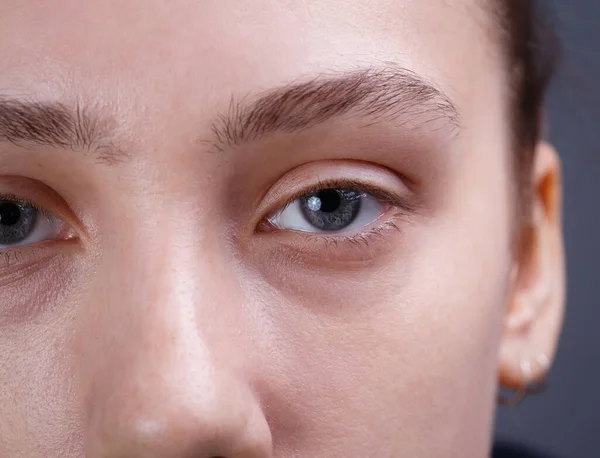 Photo of young womans face without make-up — Stock Photo, Image