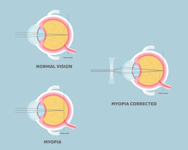 Anatomia Del Bulbo Oculare Organi Interni Parte Del Corpo Sistema — Vettoriale Stock