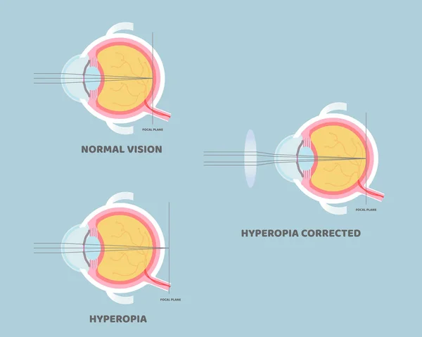 Anatomia Del Bulbo Oculare Organi Interni Parte Del Corpo Sistema — Vettoriale Stock