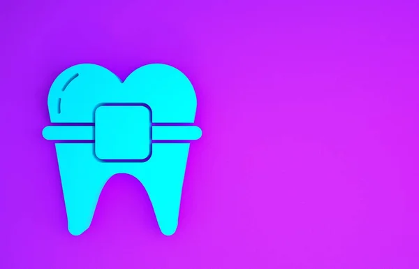 青歯は 紫色の背景に独立したブレースアイコンが付いています 歯の一口の配置 ブレースと歯科行 歯の概念 最小限の概念 3Dイラスト3Dレンダリング — ストック写真