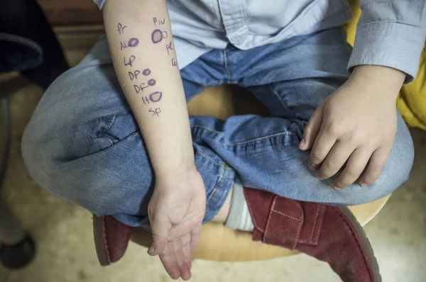 Menino Mostra Braço Depois Que Enfermeira Cercou Pontos Positivos Alergia — Fotografia de Stock