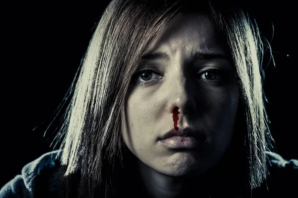 Wajah korban wanita kekerasan rumah tangga serius kekerasan serangan hidung perdarahan — Stok Foto
