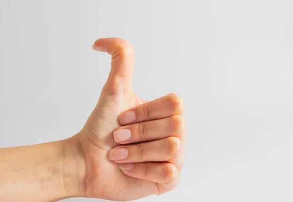 Белая Женская Рука Гипер Гибкими Большими Пальцами Изогнутые Пальцы Синдром — стоковое фото