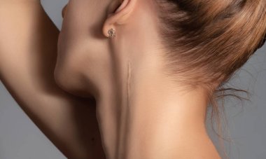 Woman with surgery scar at her neck.  clipart