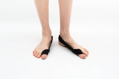  Hallux valgus, 2 bacak, yakın çekim izole edilmiş beyaz arka plan, kadın bacaklarındaki baş parmağın düzeltilmesi için ortozu dengeliyorum.