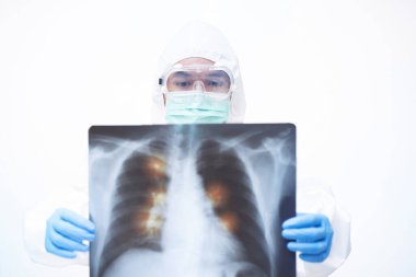 COVID-19, Coronavirus ve kişisel koruyucu ekipman ya da PPE 'de çalışan bir doktor. Hasta x-ray filmi tutuluyor