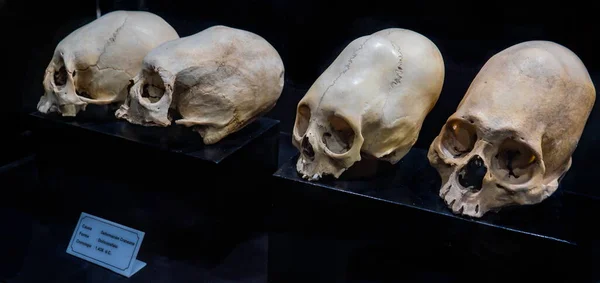 Kemik deformasyonlu eski İnka kafatasları grubu. Cusco, Peru 'daki İnka tapınaklarında bulunan kalıntılar (etikette, neden: vinç deformasyonu, şekli: dolichocephaly, tarih)