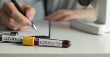 Yakın plan çekim. Doktor evrakları dolduruyor. Ön planda COVID-19 'lu test tüpleri var. Laboratuvarda yapılan deneyler. Aşı arayacağız. 4K