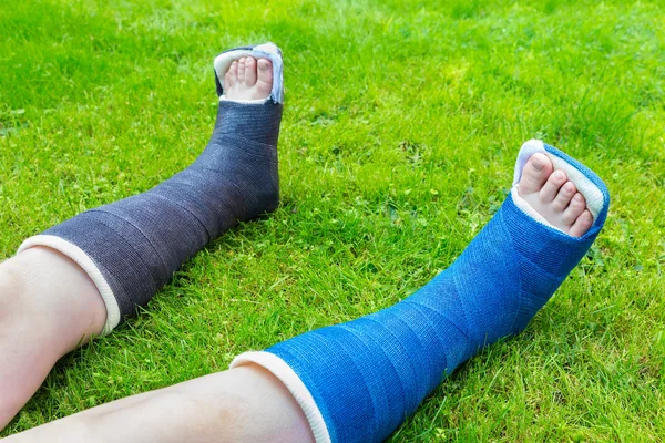 Twee gips benen van jongen op gras — Stockfoto