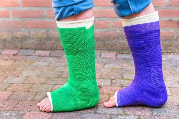 Staande kind met twee kleurrijke gips benen — Stockfoto