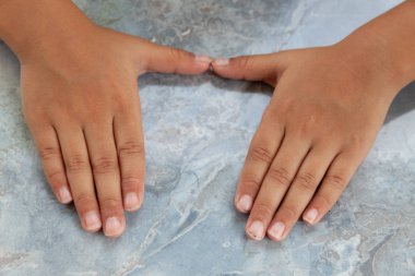 Parmağında tırnak makası var. Tırnak kesme yi kapatın. Di