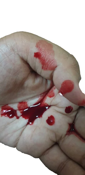 Sangue Vermelho Mão Humana Isolado Fundo Branco — Fotografia de Stock