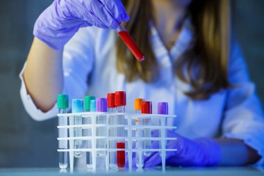 Bir tıp uzmanı, laboratuvar asistanı, doktor bir laboratuvarda analiz yapar, insan vücudunda bakteri varlığı için test tüpleri, pipet ve petri kabı kullanır.