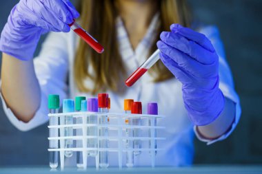 Bir tıp uzmanı, laboratuvar asistanı, doktor bir laboratuvarda analiz yapar, insan vücudunda bakteri varlığı için test tüpleri, pipet ve petri kabı kullanır.