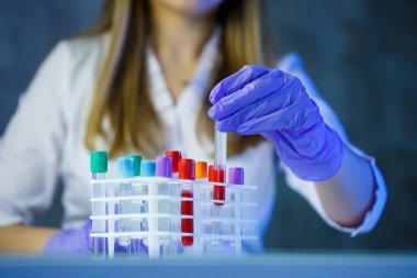 Bir tıp uzmanı, laboratuvar asistanı, doktor bir laboratuvarda analiz yapar, insan vücudunda bakteri varlığı için test tüpleri, pipet ve petri kabı kullanır.