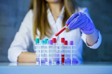 Bir tıp uzmanı, laboratuvar asistanı, doktor bir laboratuvarda analiz yapar, insan vücudunda bakteri varlığı için test tüpleri, pipet ve petri kabı kullanır.