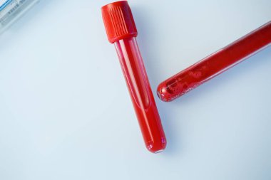 Kan analizi için test tüpleri. Virüsü kontrol et. Tıbbi Aygıtlar