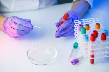 Bir tıp uzmanı, laboratuvar asistanı, doktor bir laboratuvarda analiz yapar, insan vücudunda bakteri varlığı için test tüpleri, pipet ve petri kabı kullanır.