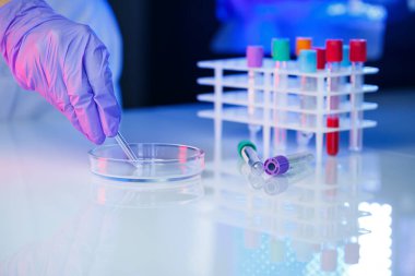 Bir tıp uzmanı, laboratuvar asistanı, doktor bir laboratuvarda analiz yapar, insan vücudunda bakteri varlığı için test tüpleri, pipet ve petri kabı kullanır.