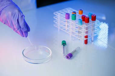 Bir tıp uzmanı, laboratuvar asistanı, doktor bir laboratuvarda analiz yapar, insan vücudunda bakteri varlığı için test tüpleri, pipet ve petri kabı kullanır.