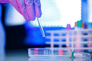 Bir tıp uzmanı, laboratuvar asistanı, doktor bir laboratuvarda analiz yapar, insan vücudunda bakteri varlığı için test tüpleri, pipet ve petri kabı kullanır.