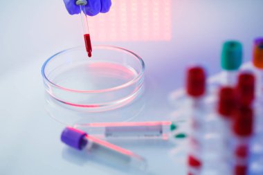 Bir tıp uzmanı, laboratuvar asistanı, doktor bir laboratuvarda analiz yapar, insan vücudunda bakteri varlığı için test tüpleri, pipet ve petri kabı kullanır.