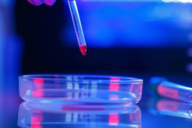 Bir tıp uzmanı, laboratuvar asistanı, doktor bir laboratuvarda analiz yapar, insan vücudunda bakteri varlığı için test tüpleri, pipet ve petri kabı kullanır.