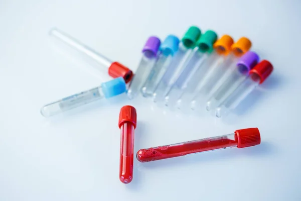 Тестові Трубки Аналізу Крові Перевір Вірус Медичні Пристрої — стокове фото