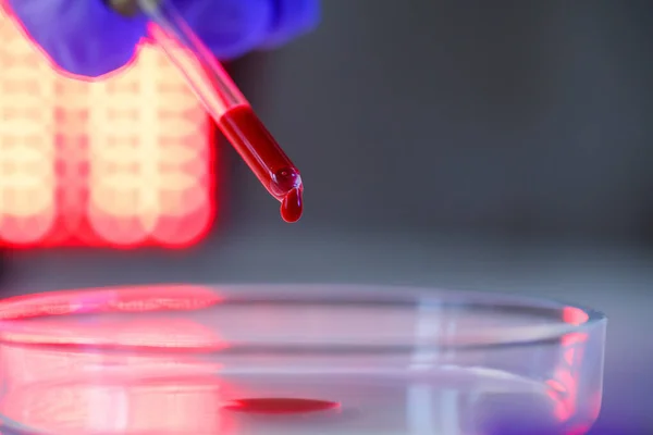 A medical professional, laboratory assistant, doctor performs an analysis in a laboratory, uses test tubes, a pipette and a petri dish for the presence of bacteria in the human body