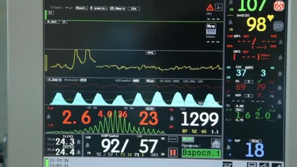 Anesteziologický přístroj na ruské klinice. — Stock video