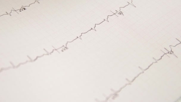 Kardiogram på ett pappersark flyttas ut ur mätanordningen. — Stockvideo