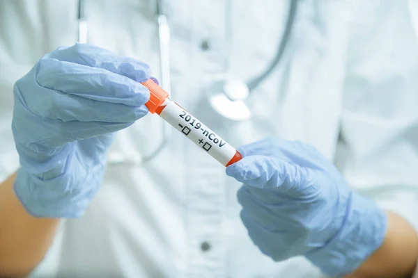 Dokter in beschermende handschoenen met reageerbuis met bloed voor 201 — Stockfoto