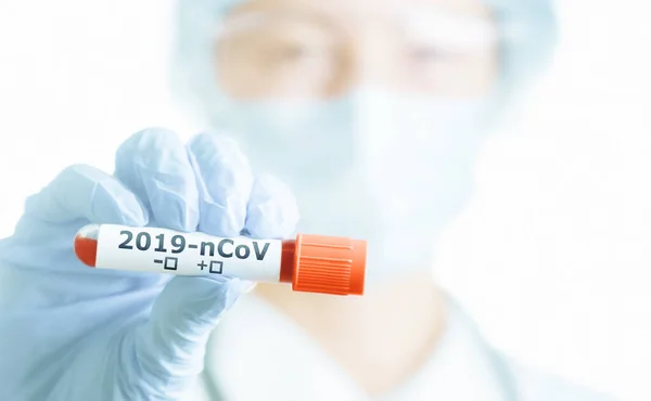 Cientista em luvas de proteção mostrando tubo de teste com sangue para — Fotografia de Stock