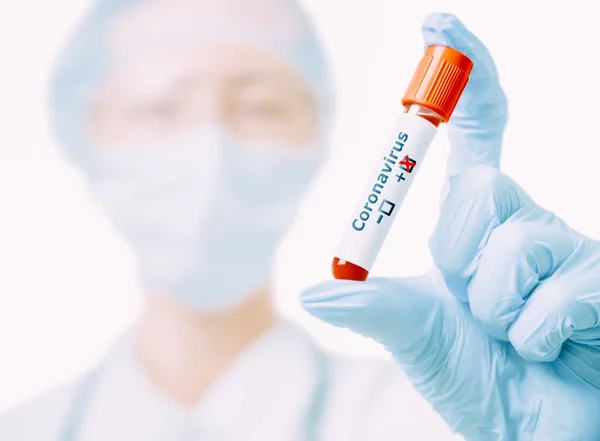 Scientist Laboratory Assistant Protective Medical Uniform Holding Tube Positive Blood — Stock Photo, Image