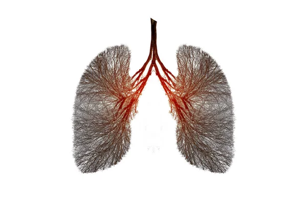 肺木のイラスト 環境医学 — ストック写真