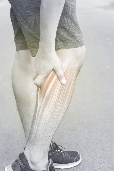 Mollets Douleur Musculaire Fond Blanc — Photo