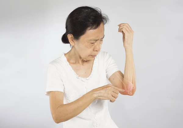 Stary Azji Kobieta Czuję Łokieć Kości Uraz — Zdjęcie stockowe